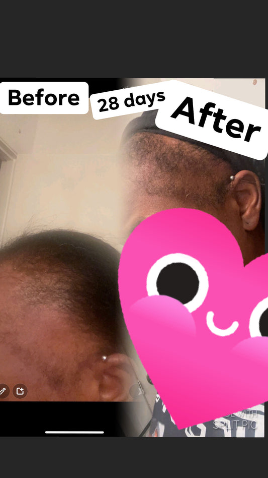 Naturalistic HAIR DROPS